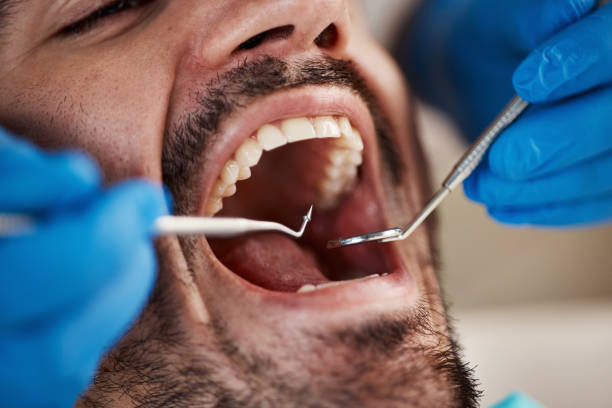 Best Teeth Whitening  in New Concord, OH