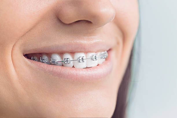 Best Veneers and Lumineers  in New Concord, OH